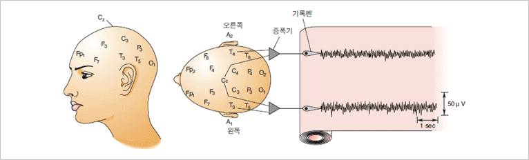 EEG 전극 부착의 표준 위치