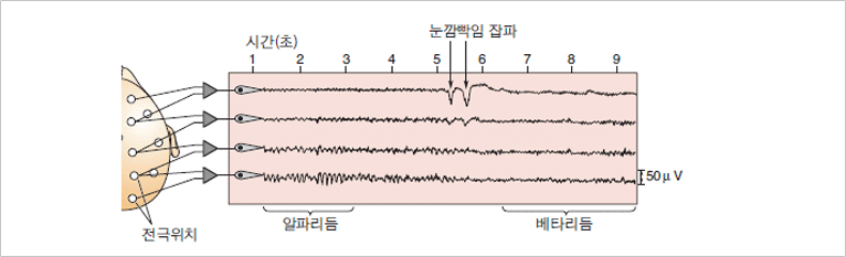 동기화 활동에 의한 큰 EEG의 발생